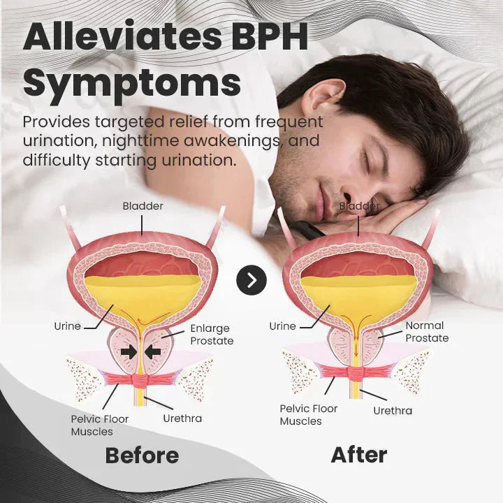 【 ✨Official Brand Store ✨】Ringmiz Copper Mag Prostate Therapy Ring(Limited Time Discount 🔥 Last Day)