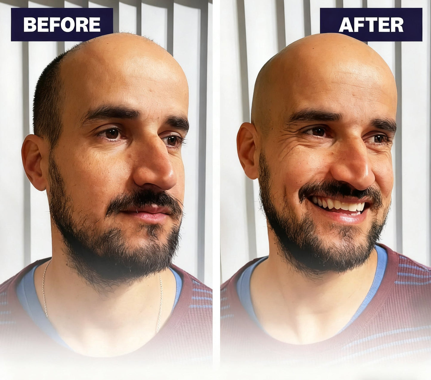 🔥Up to 60% OFF🔥Effortless Head Shaving: Must-Have Shaver For Bald Guys