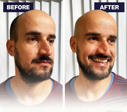 🔥Up to 60% OFF🔥Effortless Head Shaving: Must-Have Shaver For Bald Guys